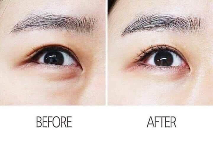 AHC Ageless Real Eye Cream For Face 30 ml • ส่วนผสมที่ทรงพลังสำหรับการชะลอวัย (Anti-Aging)  • ช่วยทำให้ผิวพรรณรอบดวงตา รวมถึงร่องลึกและริ้วรอยดูจางลง  • ลดอาการบวมของถุงใต้ตา ผิวเนียนกระชับขึ้น  • ขจัดริ้วรอยเล็กๆ (Fine lines) บนใบหน้าให้จางลง อย่างเห็นได้ชัด  